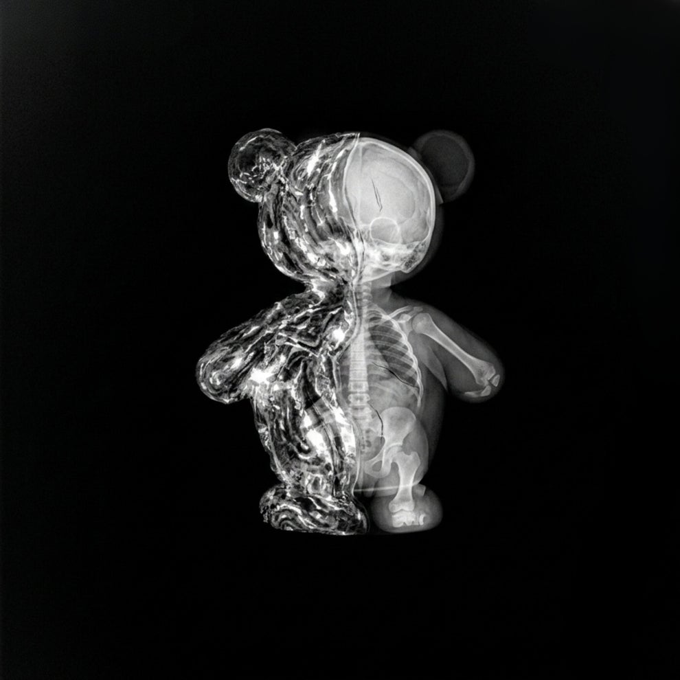 BlackGummy - Euphoria (Extended FRANK (UK)  SHAW Remix)